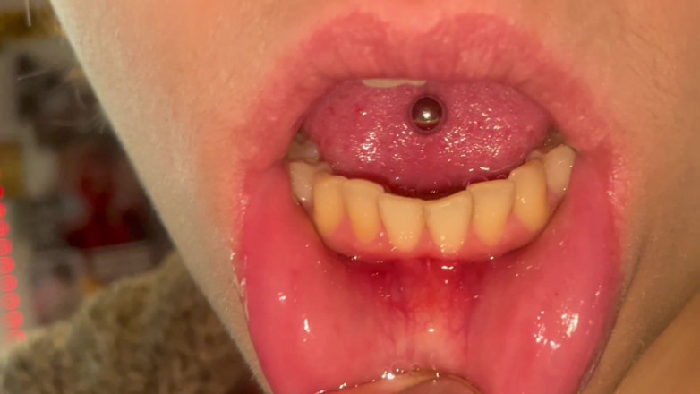 Glitterqueen1999: 口游没有化妆牙齿计数uvula检查扁桃体检查