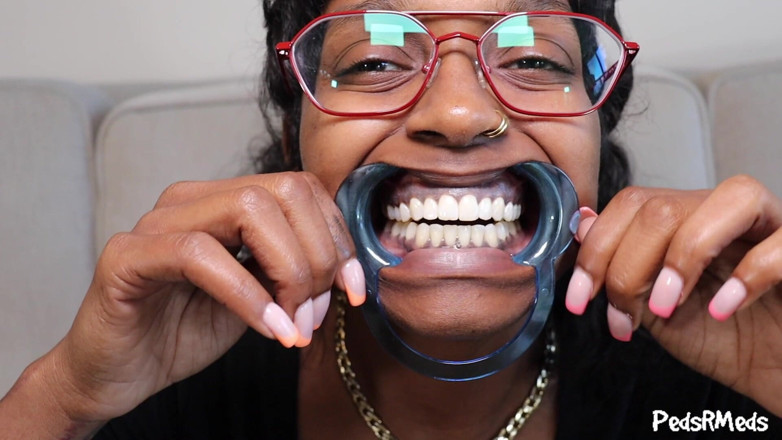 PedsRMeds: Youronlyphoenix Dental Retractor Mouth Tour