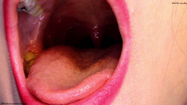 Scarlet Vixen: Горло, Uvula и рот показывает