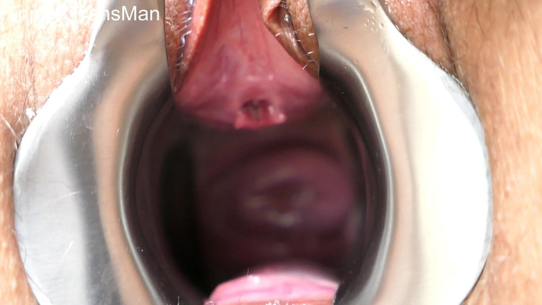 TripleXTransMan: Penetrându-mi colul uterin!