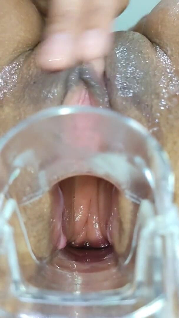 Xamy_97: Expansión anal con espéculo