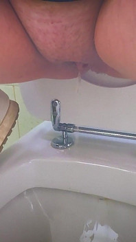Pisciare Sporco in Ospedale