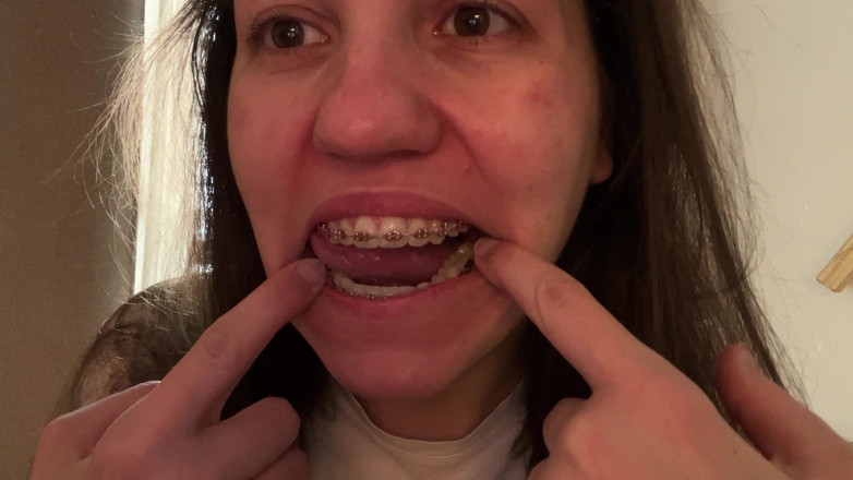 NicoleRay: Облизывать брекеты языком