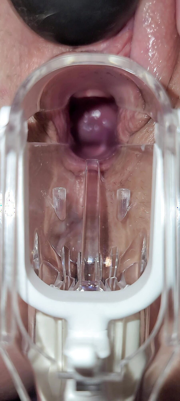 Contraby: Speculum Cervix Orgasme Sampai Muncrat