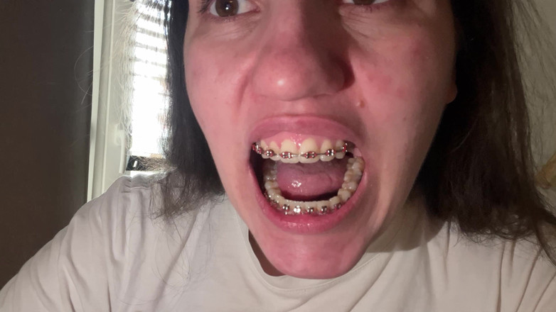 NicoleRay: Menjilati kawat gigi dengan lidah Anda