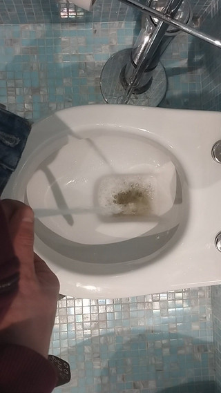 Bayer911: POV sika w toalecie