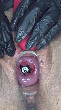 Cervix Check