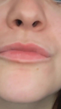 Alison's Mouth Inspection and Spit Play