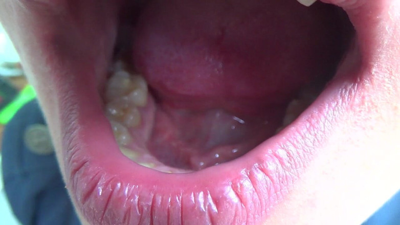 Sexy Milf: Kate open her mouth wide for you