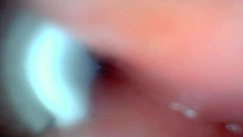 Ladybottox: Endoscope Camera Captures Moment of Male Ejaculation 4K