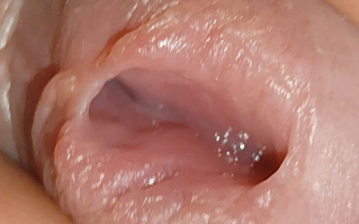 Straight Daddy Club: Alargamento Do Profundo Buraco De Uretra!!!