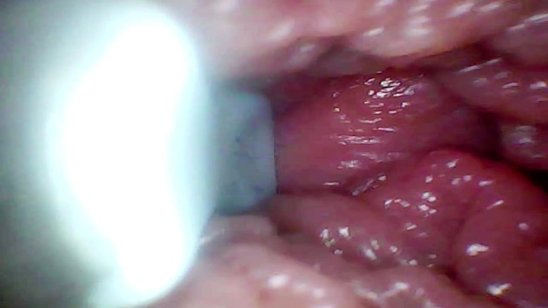 Ladybottox: Endoscope Camera Records My Wife's G Spot. Educational Video Close...