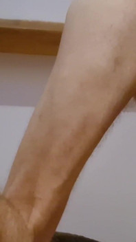 전립선 비 빨기