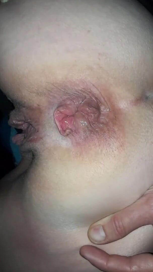 Berlin Couple: Amateur outdoor-anal in berlin