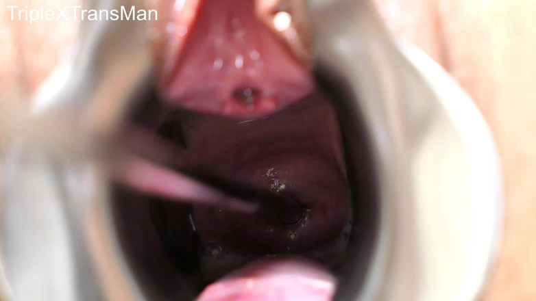 TripleXTransMan: Penetrace mého děložního čípku!