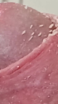 Smegma Foreskin Roll. bigpisser