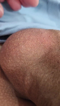 A Small Brazilian Penis