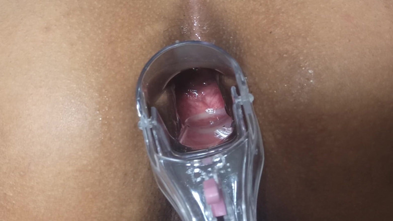 Xamy_97: 내 후장 2부에 있는 Speculum