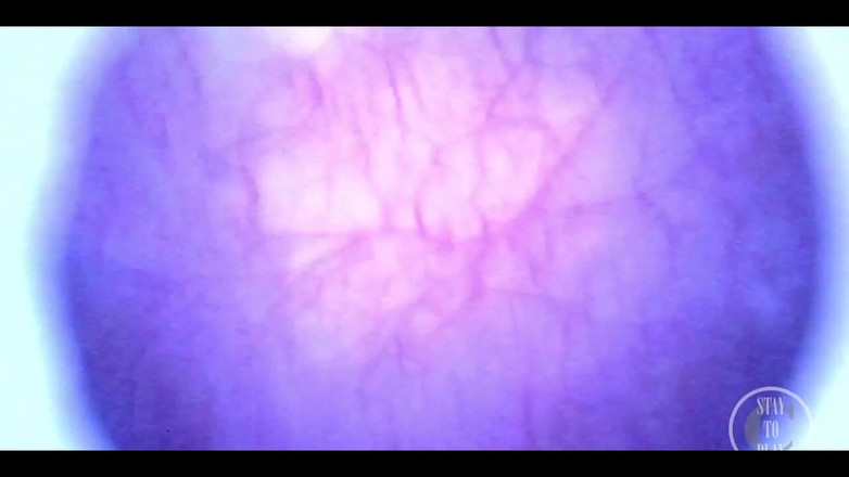 Lina Free: 美丽的第一人称视角内窥镜我那完整的膀胱！