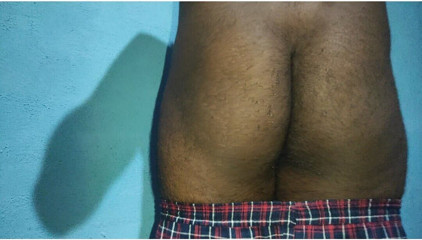 Horney: Indian Dick