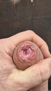 Phimosis Cock Cumming at Work!