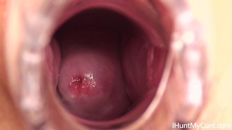 I Hunt My Cunt: Young nurse gapes her pussy and shows her cervix through...