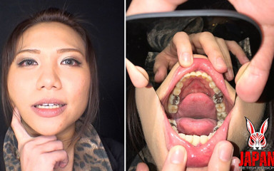 Japan Fetish Fusion: Teeth Obsession Unleashed: the Sensational Video Starring Reina Kitamura