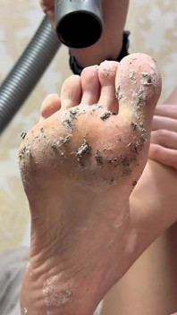 kaki yang melampau! Tapak Kotor & Vakum Berlebihan