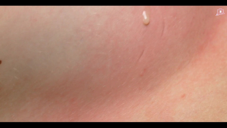 Medi Voi: 你想要味道吗？