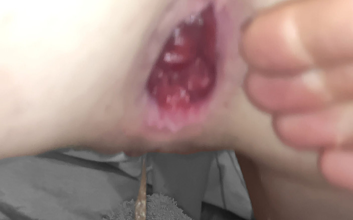 In Need of the Fist: Tôi đã dùng tay đấm vào lỗ đít con điếm 21f của mình trong khi...