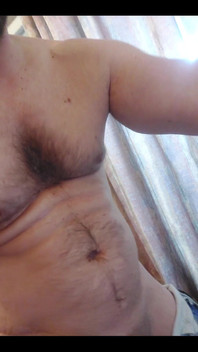 Speciální žádost stříkání