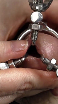 Dilation of the Hole Expanded Glans and Sperm Blockage Through Urethral Insertion of the Finger - Closeup