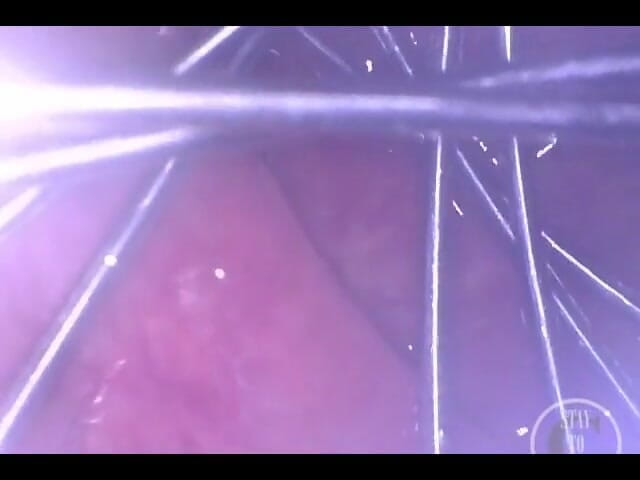 Lina Free: Whisk Roztahuje mi zadek dovnitř