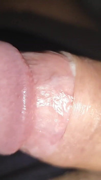 Incredible Cock, Unique of Slippery Phimosis by the Robust Body.