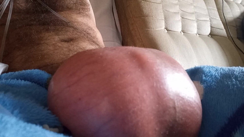 Lion big balls: 볼 식염수