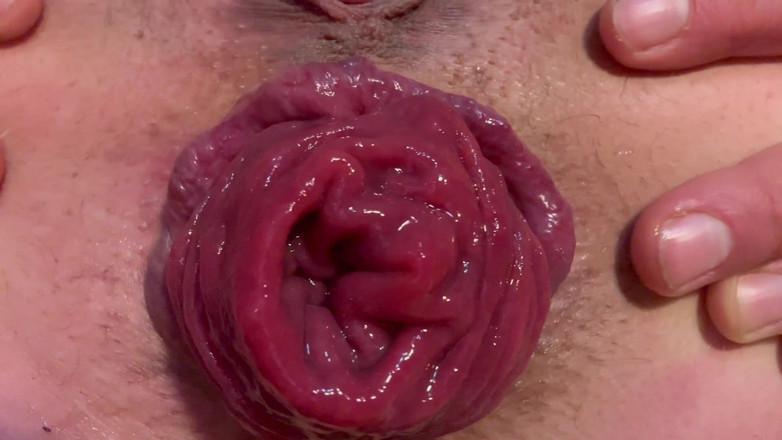 Putarankahotmilf: Arsch ausgebreitet Nahaufnahme Prolaps und Füße zeigen in weißen nylons