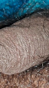 Hairy Panes