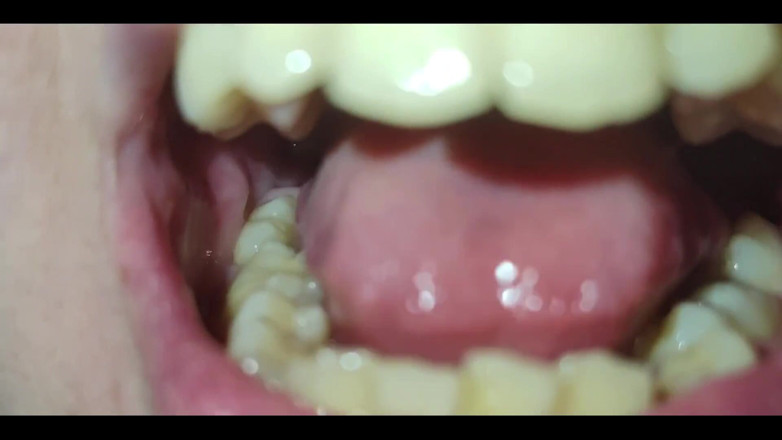 RavenHearth666VIP: A Close-up of My Throat