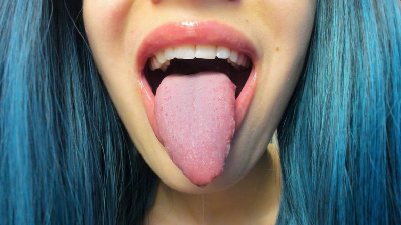 Rarible Diamond: Z jazyka mi kape slintá slintá