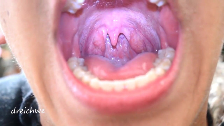 Dreichwe: Uvula fetish mouth