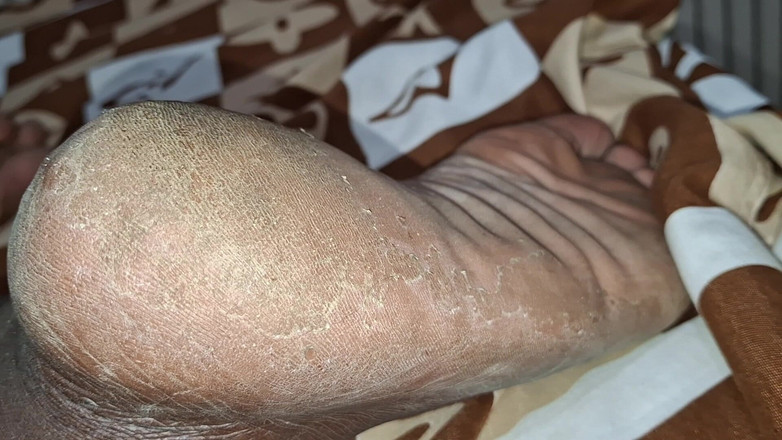 BMCs: 猪有大腿，并要求一个绿帽男来舔那里有的戴绿帽子的专辑