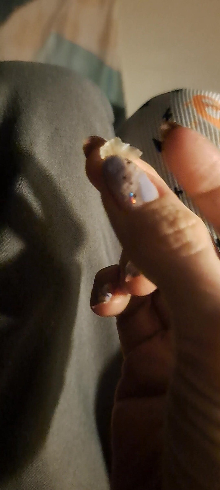 PandoraSG: Пілінг величезного пластівця шкіри