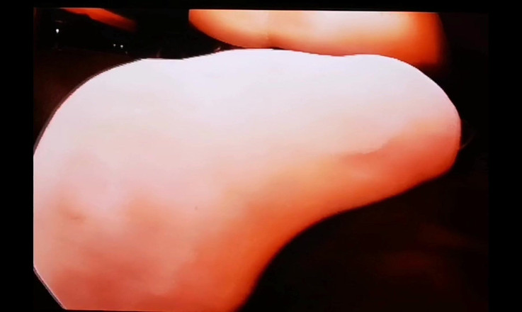 Monster_Meat_: EXTREMEs video. Mit Glucose 2,5liter gefüllt