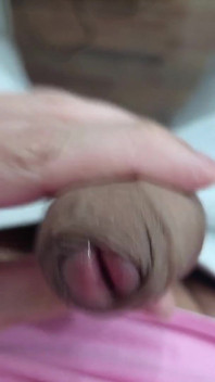 The Head of My Penis