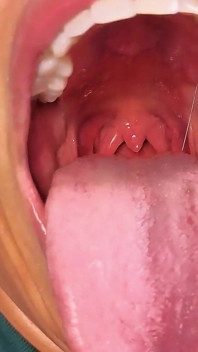 Mulut fetish uvula tutup Saya tercekik pada BBC yang keras