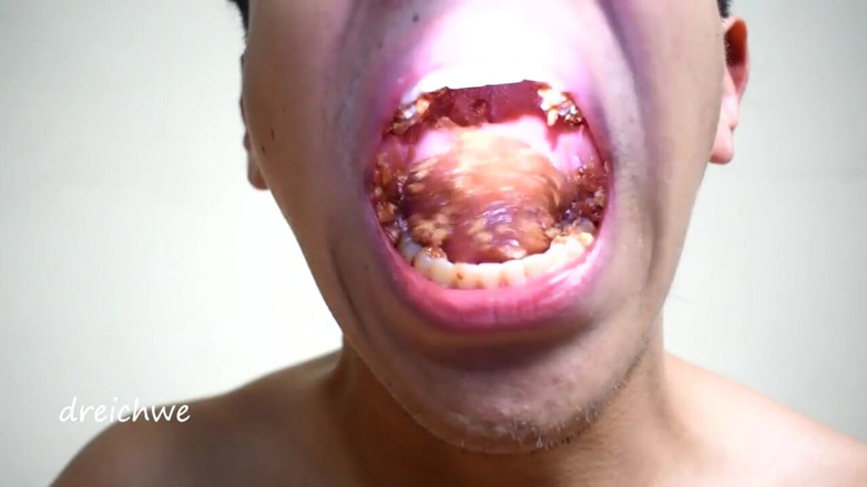 Dreichwe: Eating episode 7