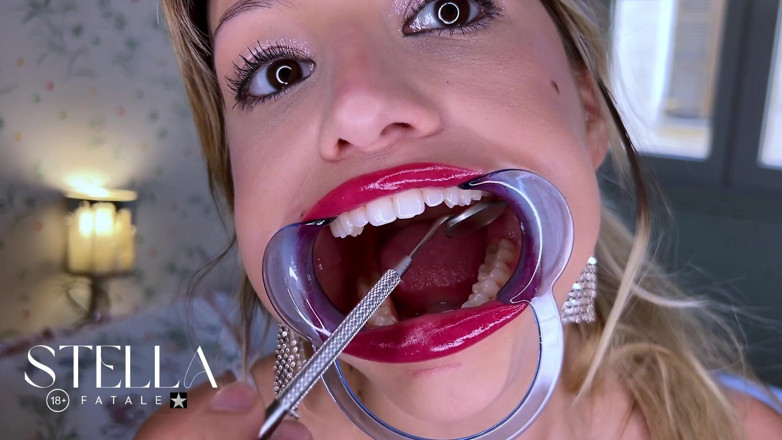 Stellafatale: Dental Tools Mouth Exam All Teeth Displayed