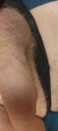 My Dick