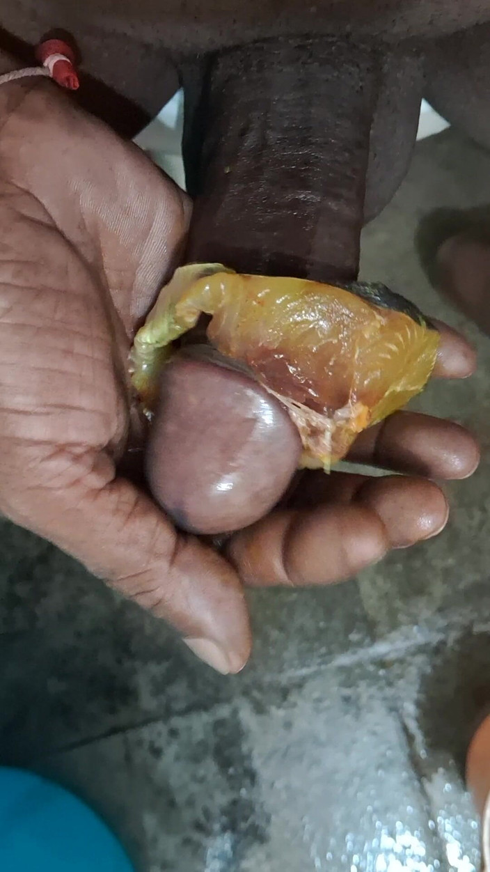 Maddymissile: Siebie