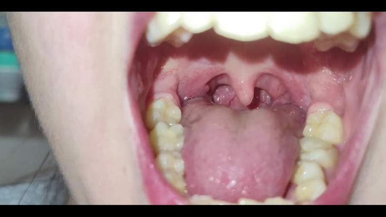 RavenHearth666VIP: A Close-up of My Throat